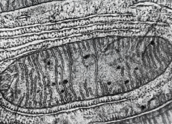 Transmission electron micrograph of a mitochondrion, showing the double membrane and folded inner membrane (cristae) where aerobic respiration occurs.